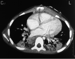 graphic file with name 978-3-662-57295-5_10_Fig2_HTML.jpg