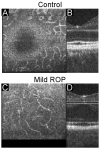 Fig. 13