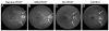 Fig. 14