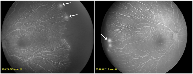 Figure 1-