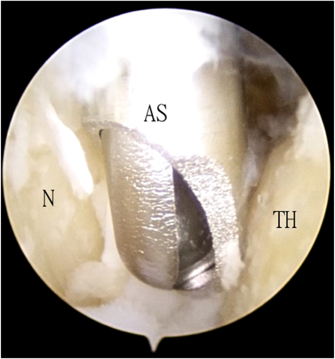 Fig 4