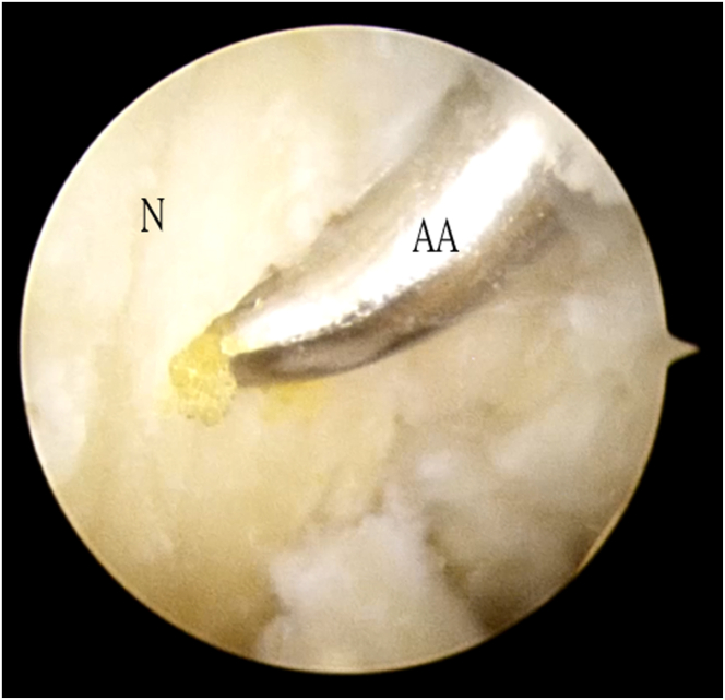 Fig 9