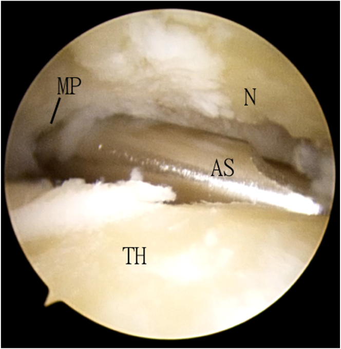 Fig 5