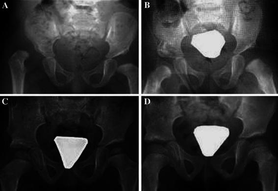 Fig. 10