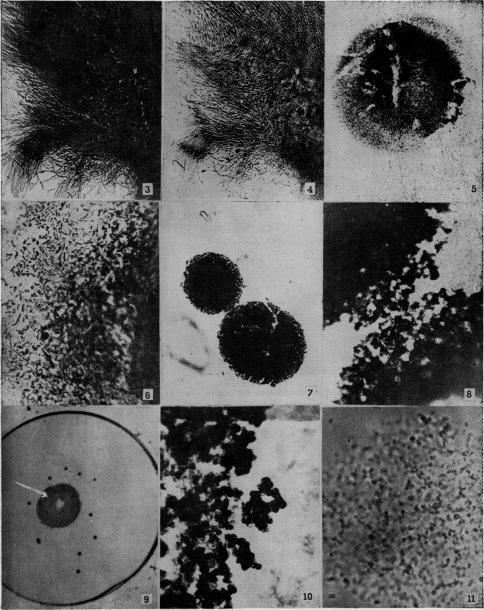 Fig. 3., Fig. 4., Fig. 5., Fig. 6., Fig. 7., Fig. 8., Fig. 9., Fig. 10., Fig. 11.