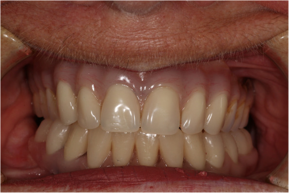 Fig. 6