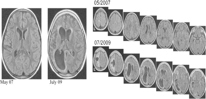 Fig. 4