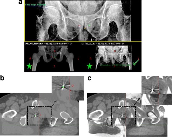 Fig. 6