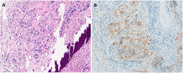 Figure 2