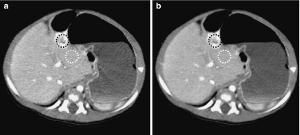 Fig 12.