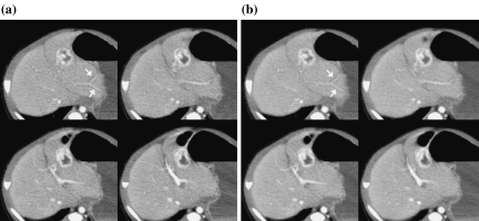 Fig 14.