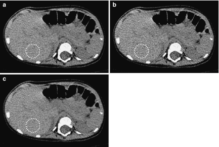 Fig 13.