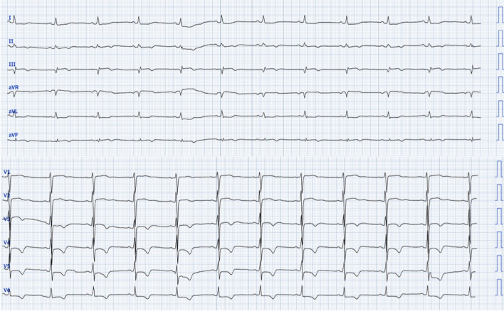 Fig. 1