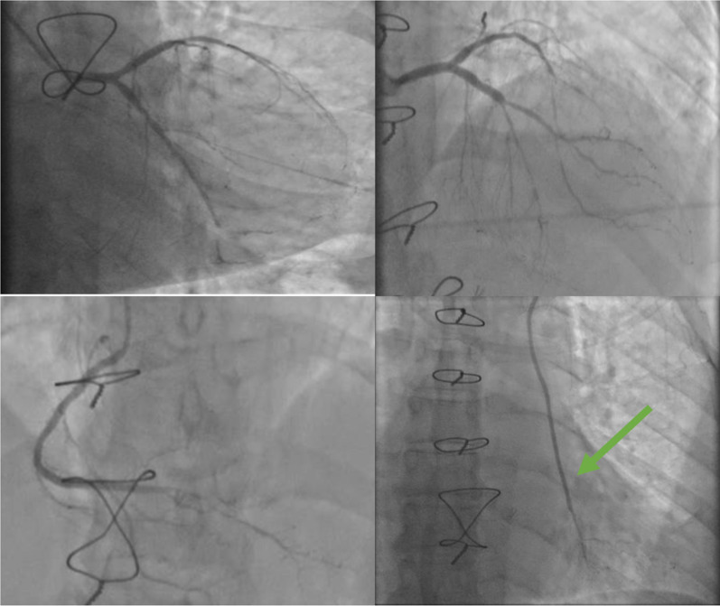 Fig. 3