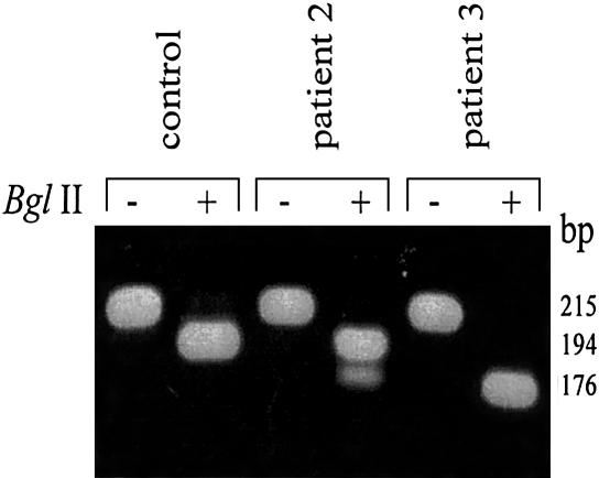 Figure  2