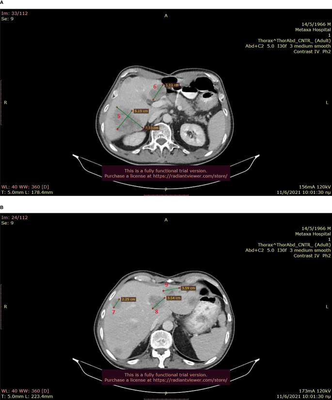 Figure 2