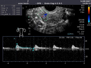 Fig. 6