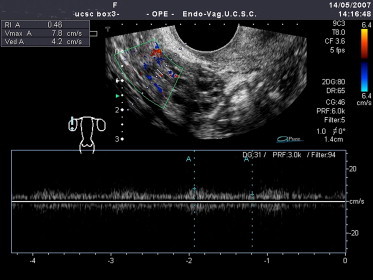 Fig. 7