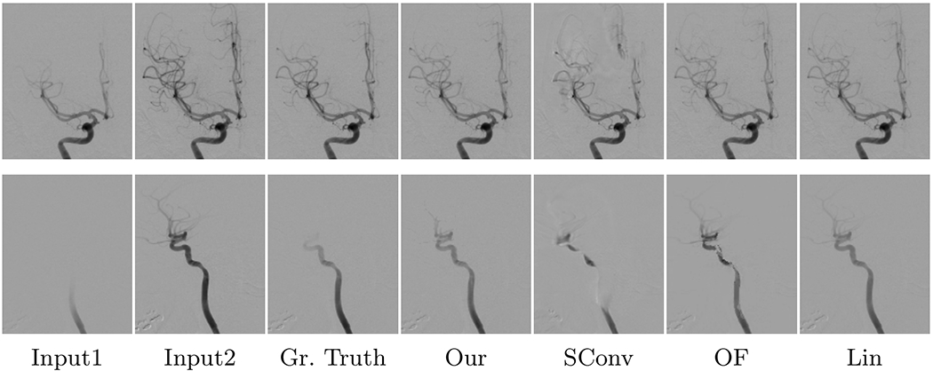 Estimation Of High Framerate Digital Subtraction Angiography Sequences