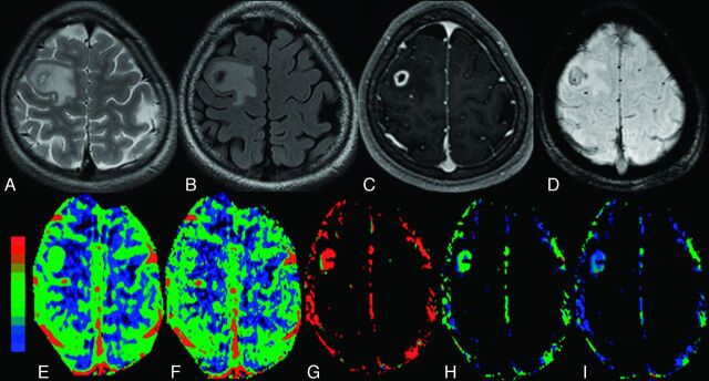 Fig 1.