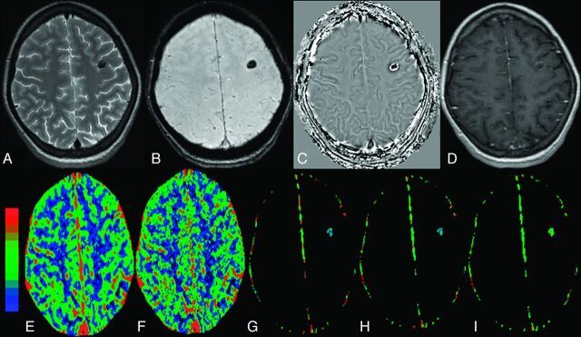 Fig 3.