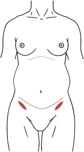 Fig 1