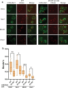 Figure 2—figure supplement 1.
