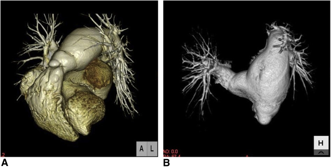 Figure 3