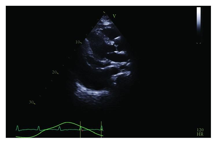 Figure 4