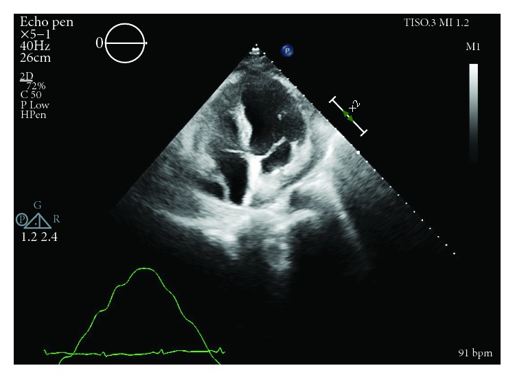 Figure 2