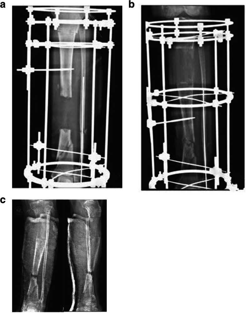 Fig. 4