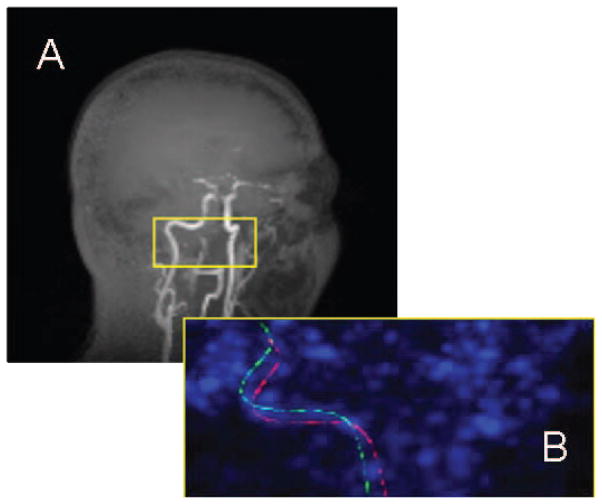 Fig. 1