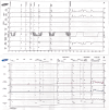 Fig. 2