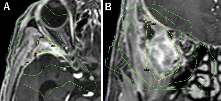 Fig. 3: