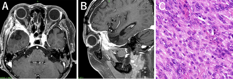 Fig. 2: