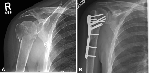 Fig. 2A–B