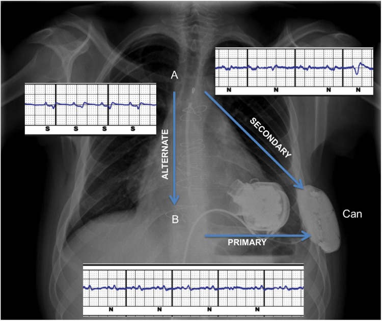 Figure 2