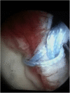 Fig. 1