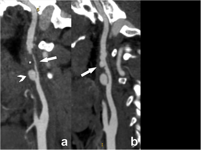 Fig. 11