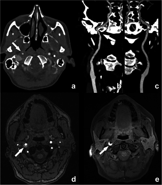 Fig. 10