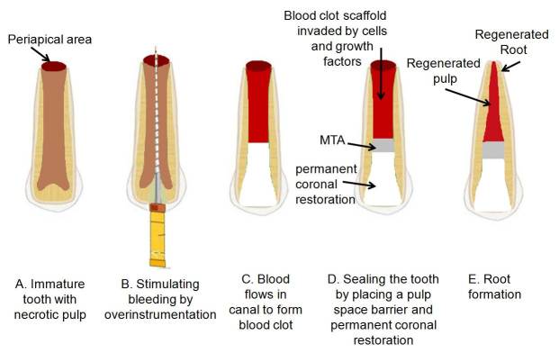 [Table/Fig-2]: