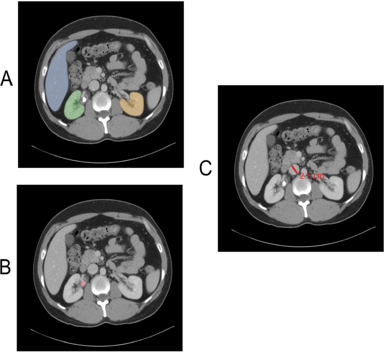 Fig. 1