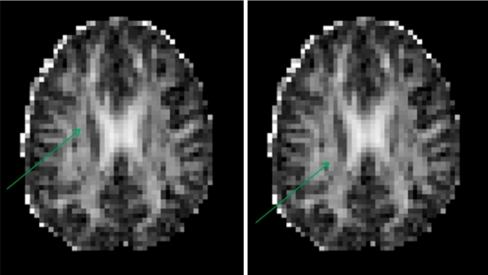 Fig. 2