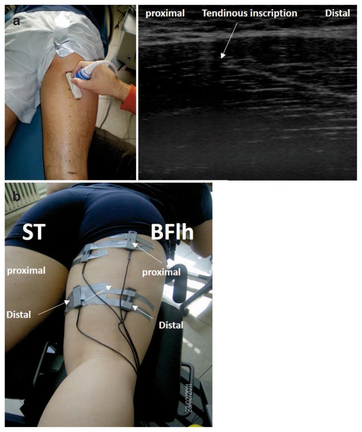 Figure 1 a, b