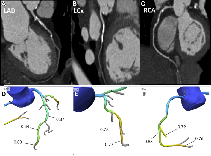 Figure 3