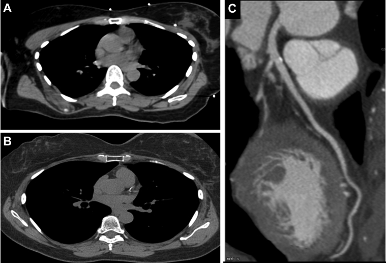 Figure 1