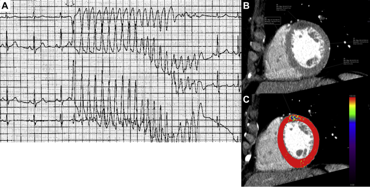 Figure 4