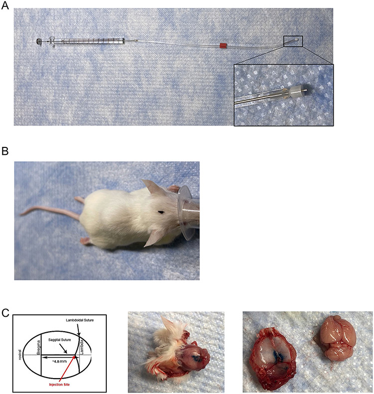 Figure 1: