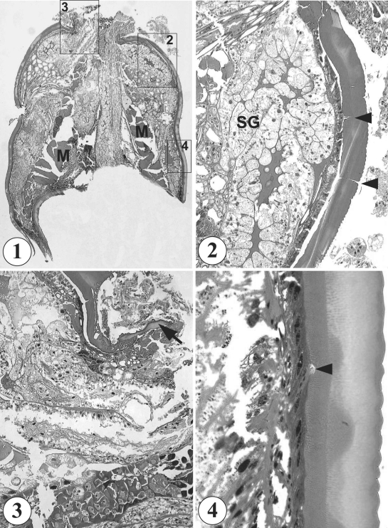 Fig. 1-4