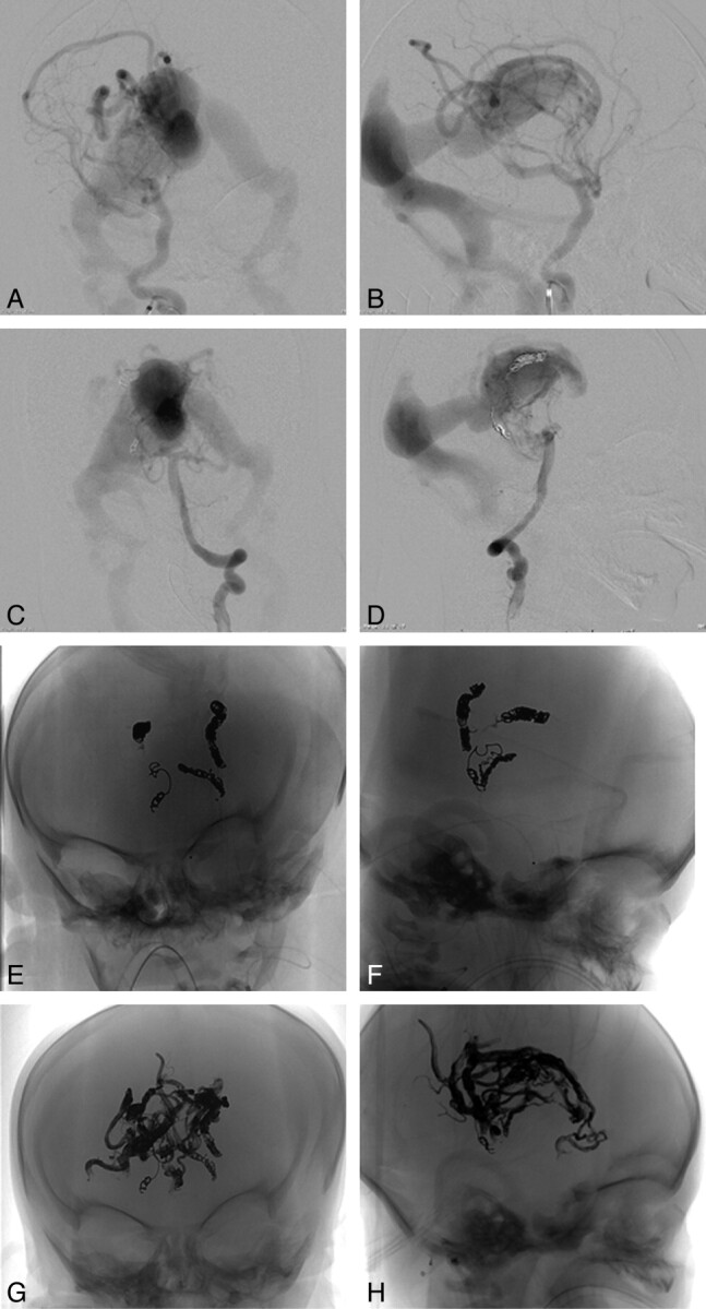 Fig 3.